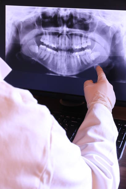 Best Emergency Root Canal Treatment in Charlotte, TN